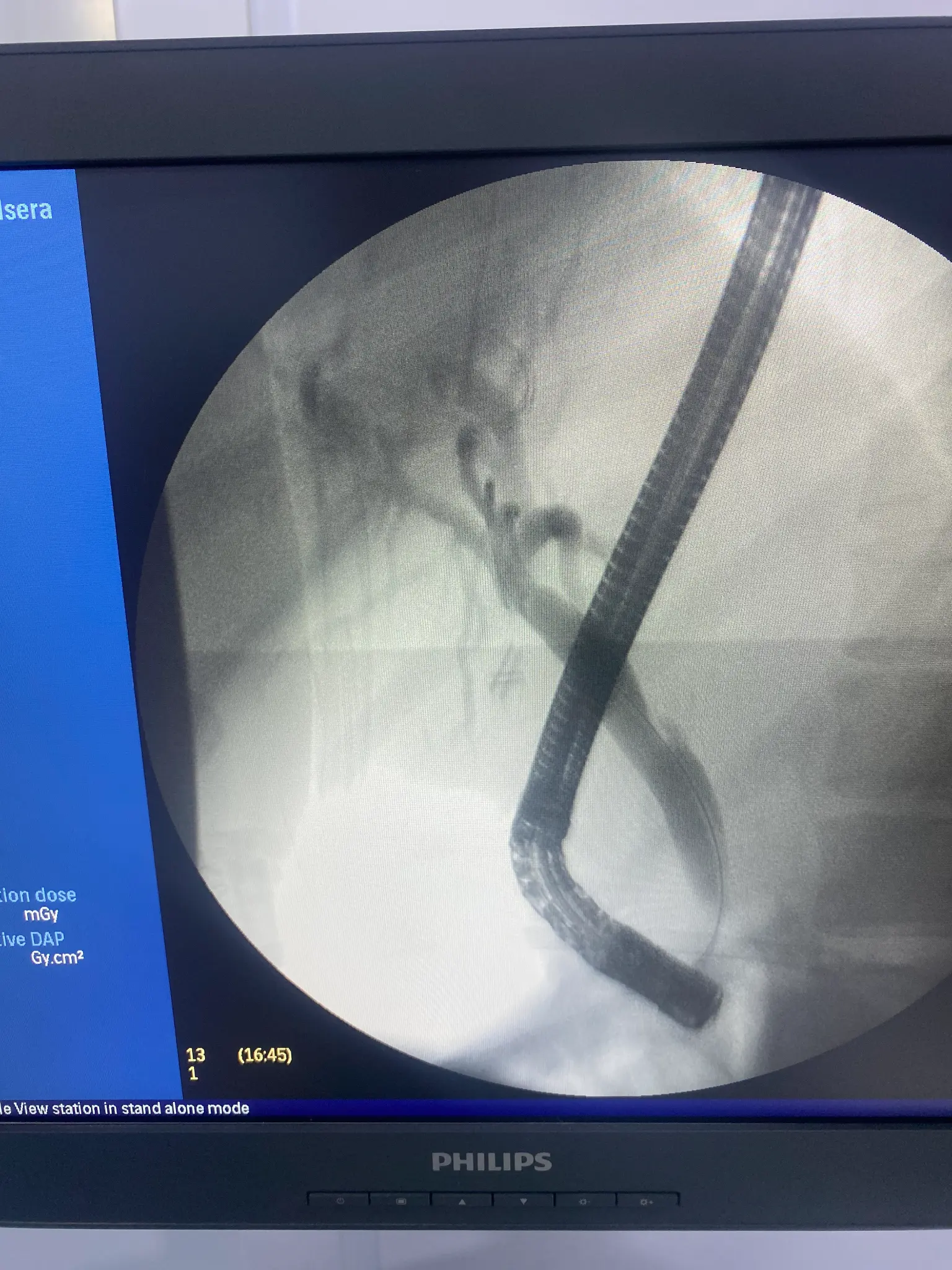 ERCP Intervention 7